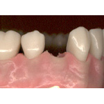 Gesunde Nachbarz&auml;hne