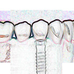 Schraube in Zylinderform